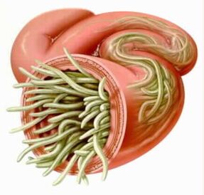 Parasites in the gut