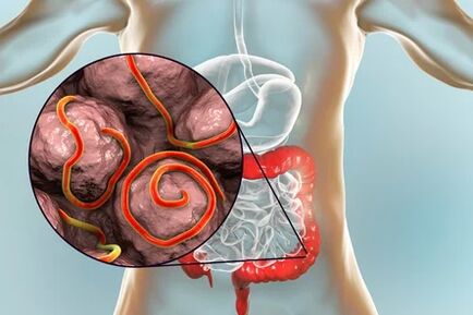 Parasites in the gut