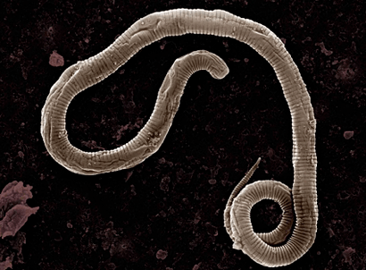 Where do the worms of the human body come from