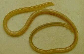 Types of parasites in the human body