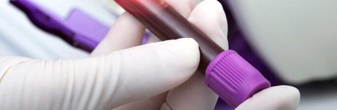 blood for parasite examination